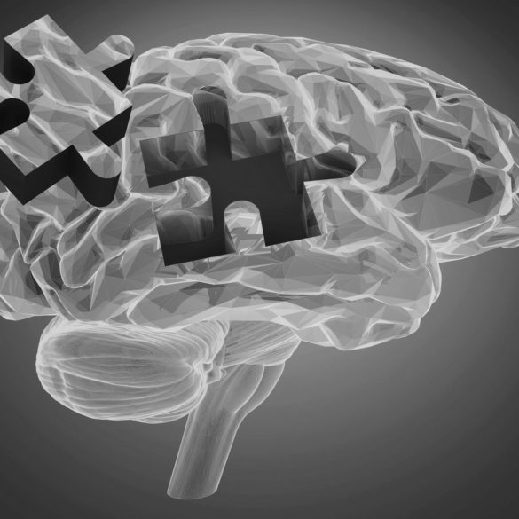 La fisioterapia en el Daño Cerebral Adquirido (DCA)